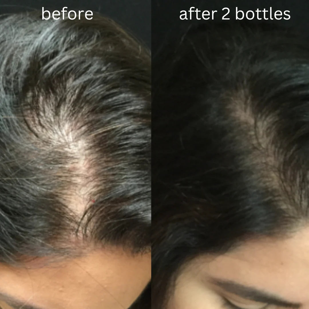 Hair Bloom Oil (Hair Growth + Shine)