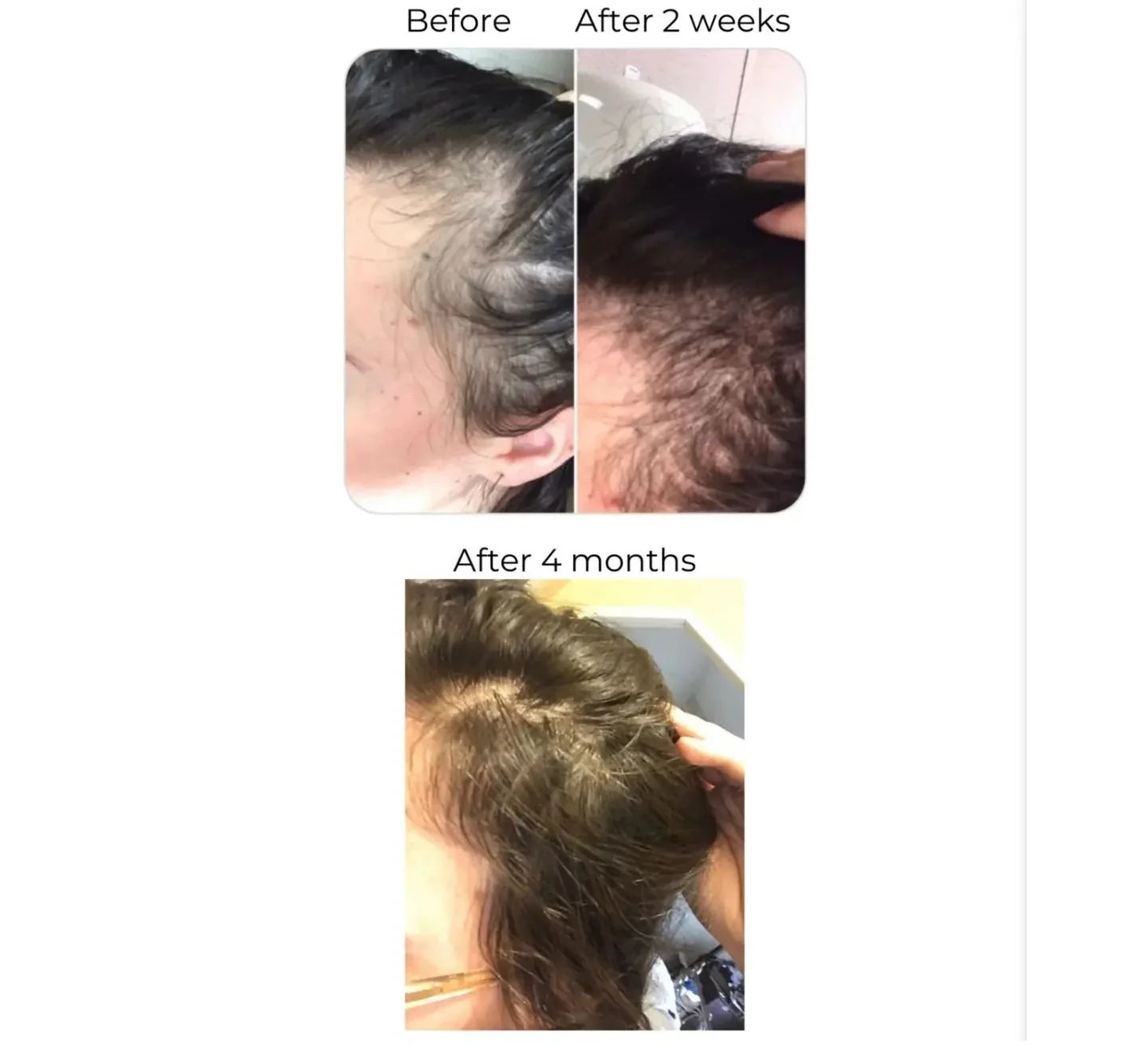 Hair Bloom Oil (Hair Growth + Shine)